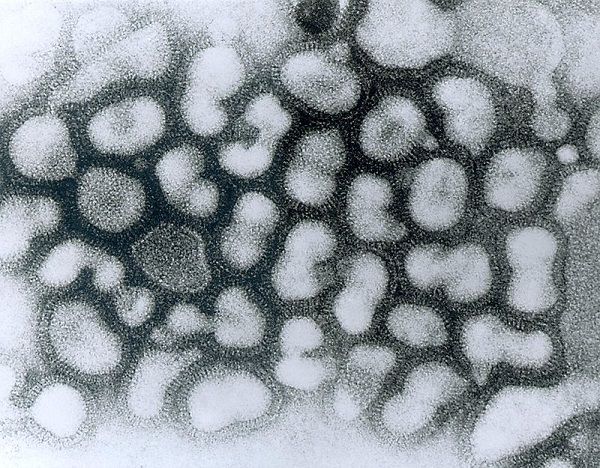 H5N1 là gì,Virút H5N1 là gì,virus cúm gia cầm H5N1 là gì,virus cúm gia cầm H5N1,tác hại của H5N1,triệu chứng của H5N1,phòng ngừa H5N1,Điều trị H5N1