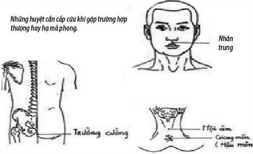 Thượng mã phong là gì,Thượng mã phong,cách chữa thượng mã phong,cách cấp cứu thượng mã phong,mã thượng phong,phạm phòng là gì,phạm phòng,trúng phong,trúng phòng,đột tử,triệu chứng thượng mã phong,xử lý thượng mã phong,tẩu dương là gì,tẩu dương,hạ mã phong,cách phòng ngừa đột tử